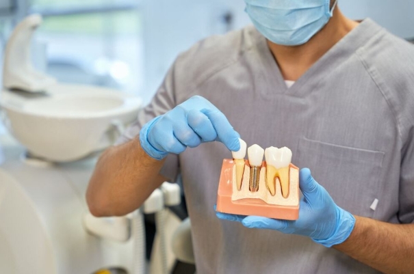 Descubre las diferentes Prótesis Dentales